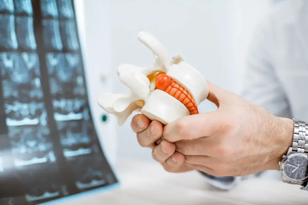 A doctor holding a model of a spinal cord